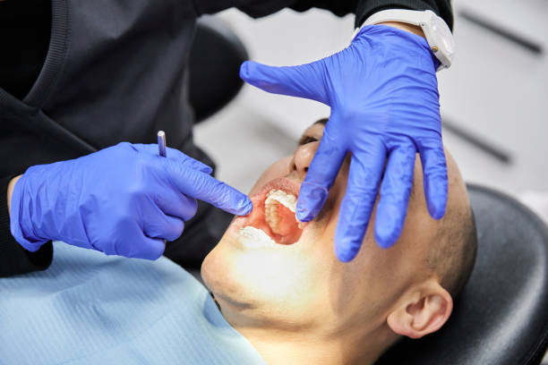 Best Chipped Tooth Repair Near Me  in Joseph City, AZ